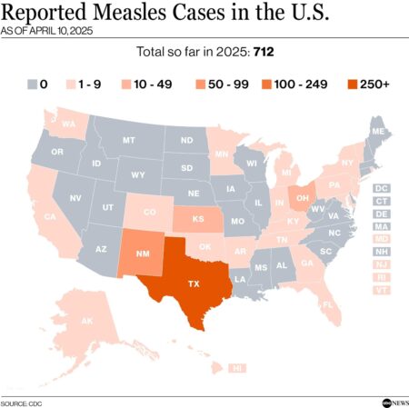 The US is having its worst year for measles in more than three decades – KSAT